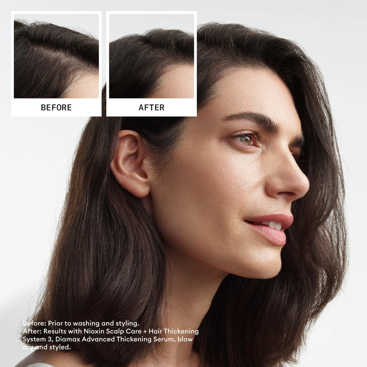 Nioxin System #3 Conditioner