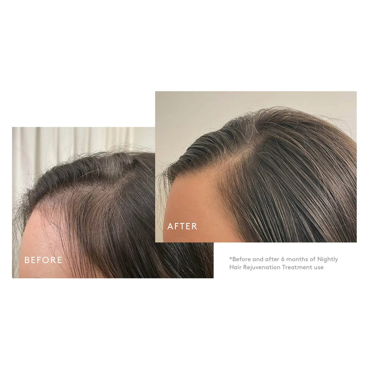 Virtue Flourish® Intensive Hair Rejuvenation Treatment - Blend Box