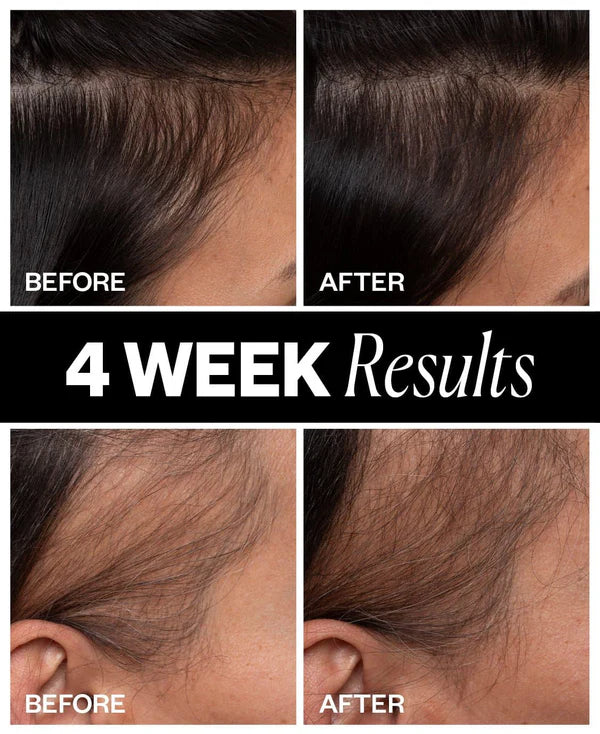 IGK Sponsored Scalp Hair Density Treatment