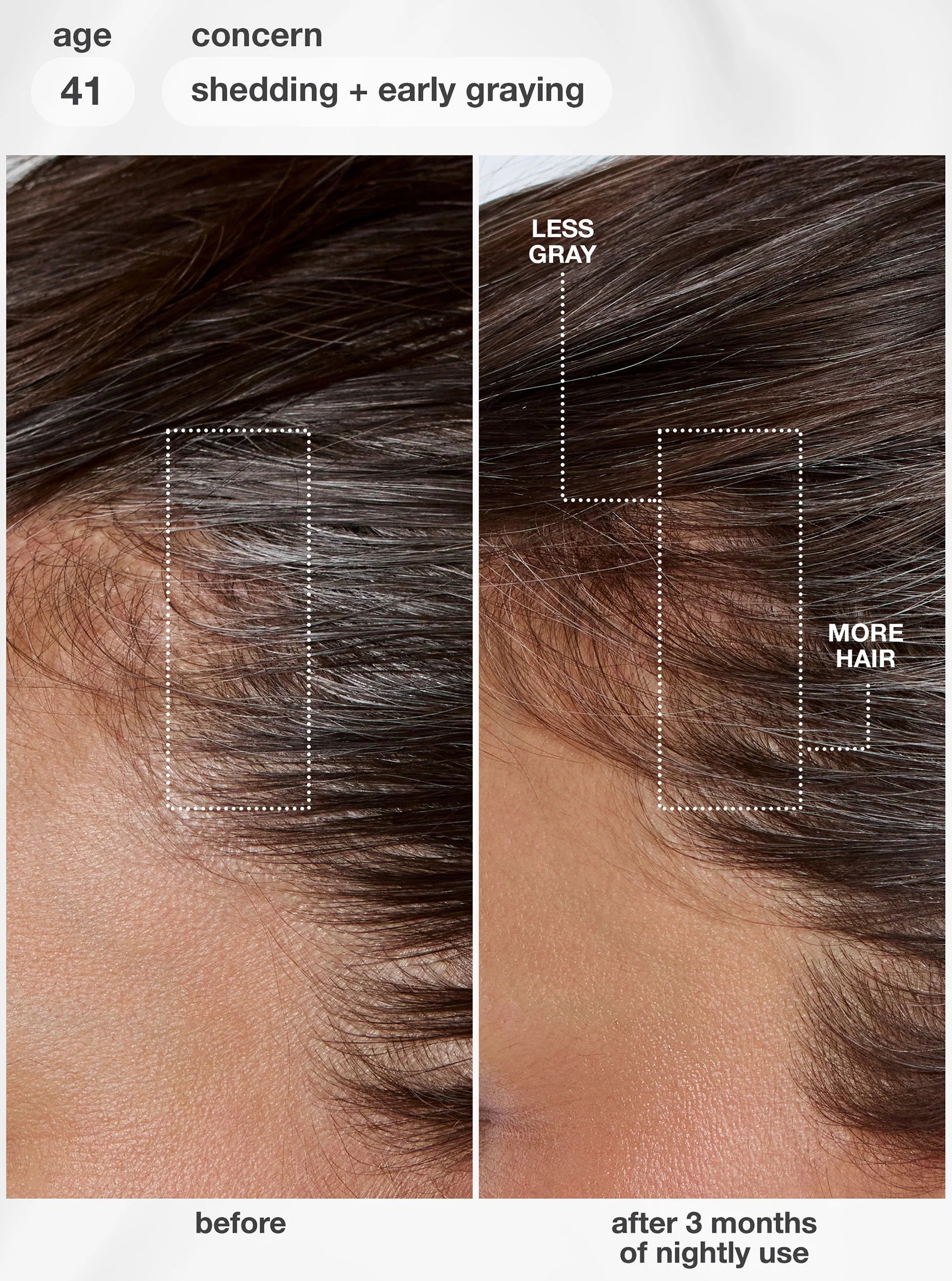 FutureIQ biomimetic hair longevity serum - 90mL