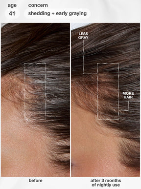 FutureIQ biomimetic hair longevity serum - 90mL