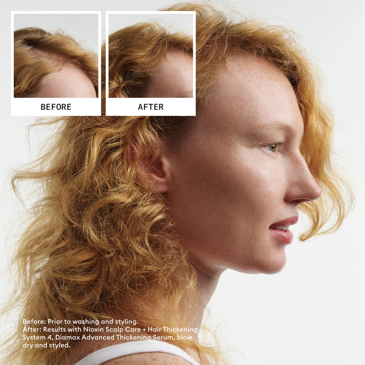 Nioxin System 4 Duo