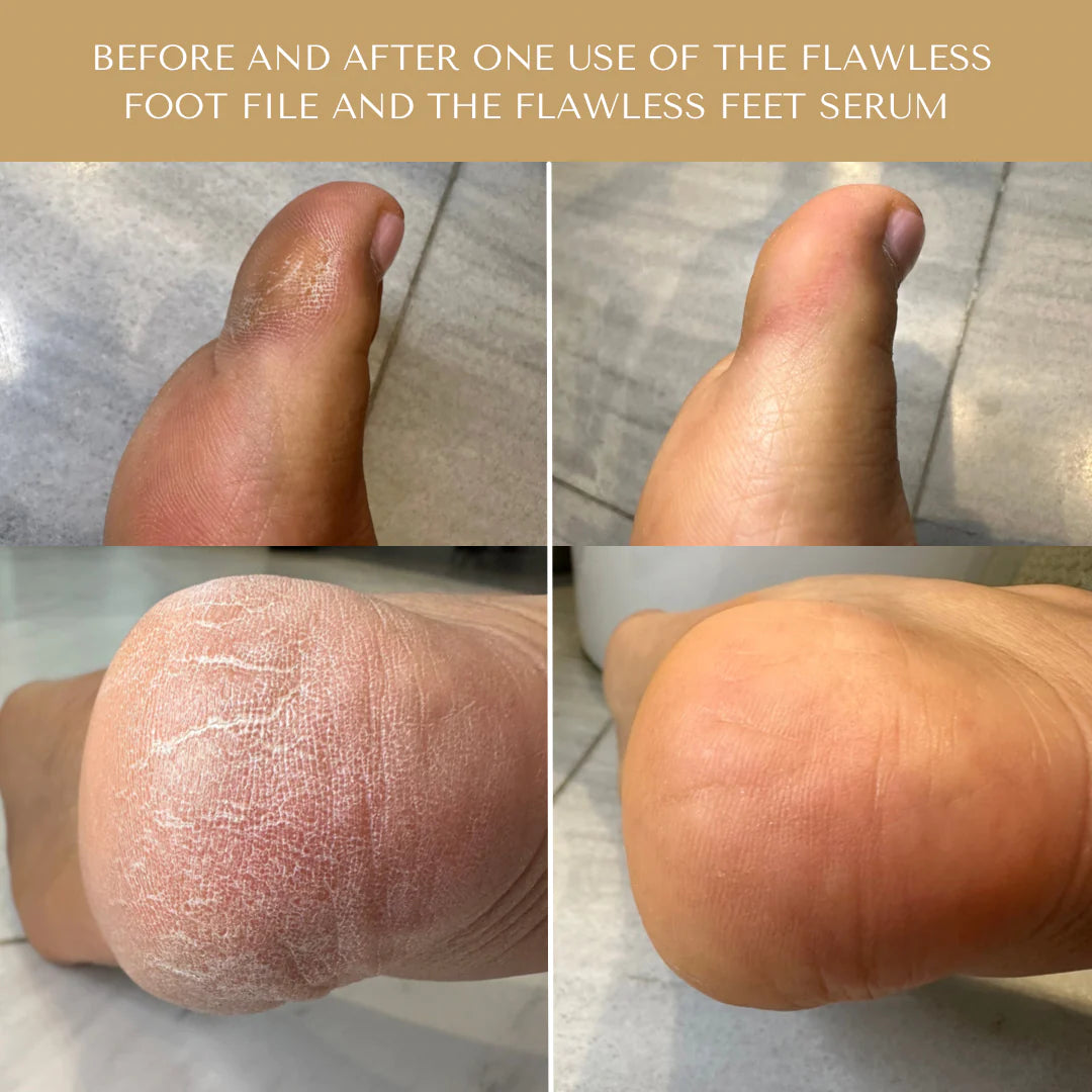 Serum Doctor Foot File
